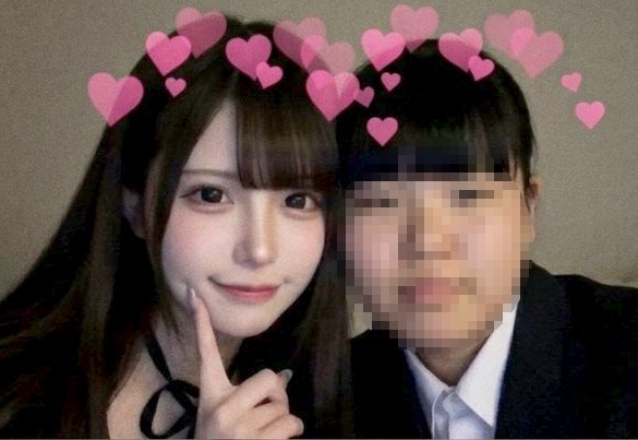 【画像】女さん「整形後と整形前のツーショ私もやって見たけど、泣ける????」