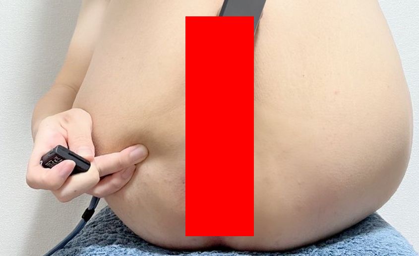 【閲覧注意】まんさん、セッ〇スのやりすぎでアソコがとんでもないことになる????！！！